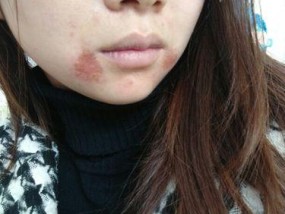 热水器开关流黄水怎么办（解决热水器开关流黄水的有效方法）