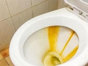 热水器除水垢的有效方法（清洁热水器）