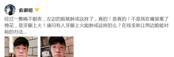 吹空调导致脸部肿胀，如何缓解（掌握科学方法）  第3张
