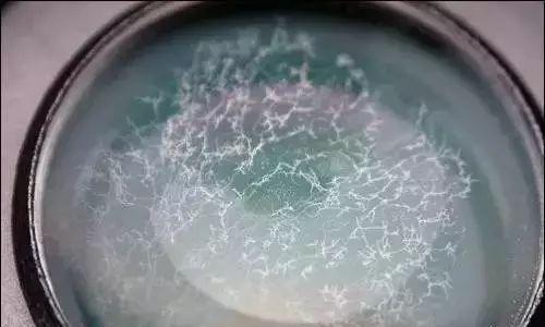 相机镜头是怎么长霉的？如何预防和处理霉变？  第3张