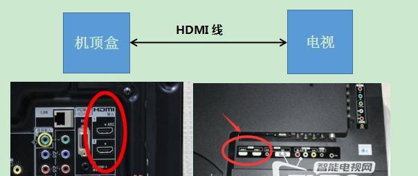 拔网电视机顶盒线时需要注意什么？  第1张