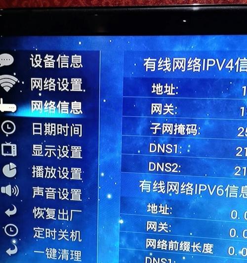 机顶盒与网络设备如何匹配？匹配步骤详细说明？  第3张